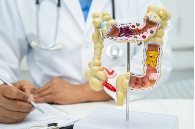 How a Colon Surgery Dr Can Improve Your Colon Health Outcomes How a Colon Surgery Dr Can Improve Your Colon Health Outcomes